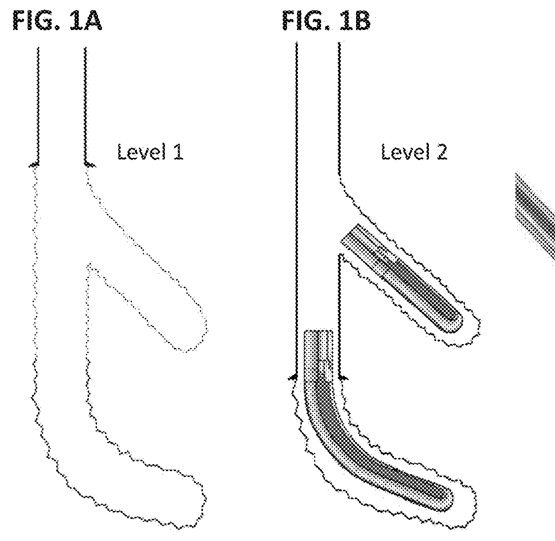 System and method for sealing multilateral junctions