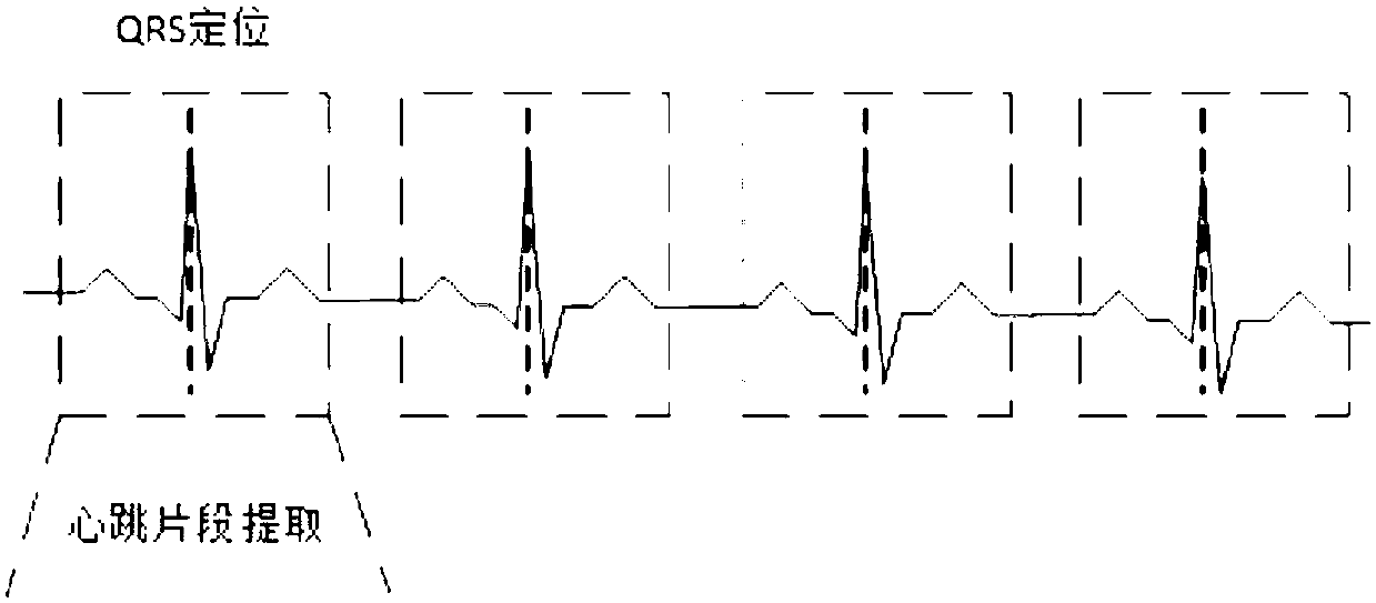 Electrocardiogram diagnosis method and system based on deep convolution neural network