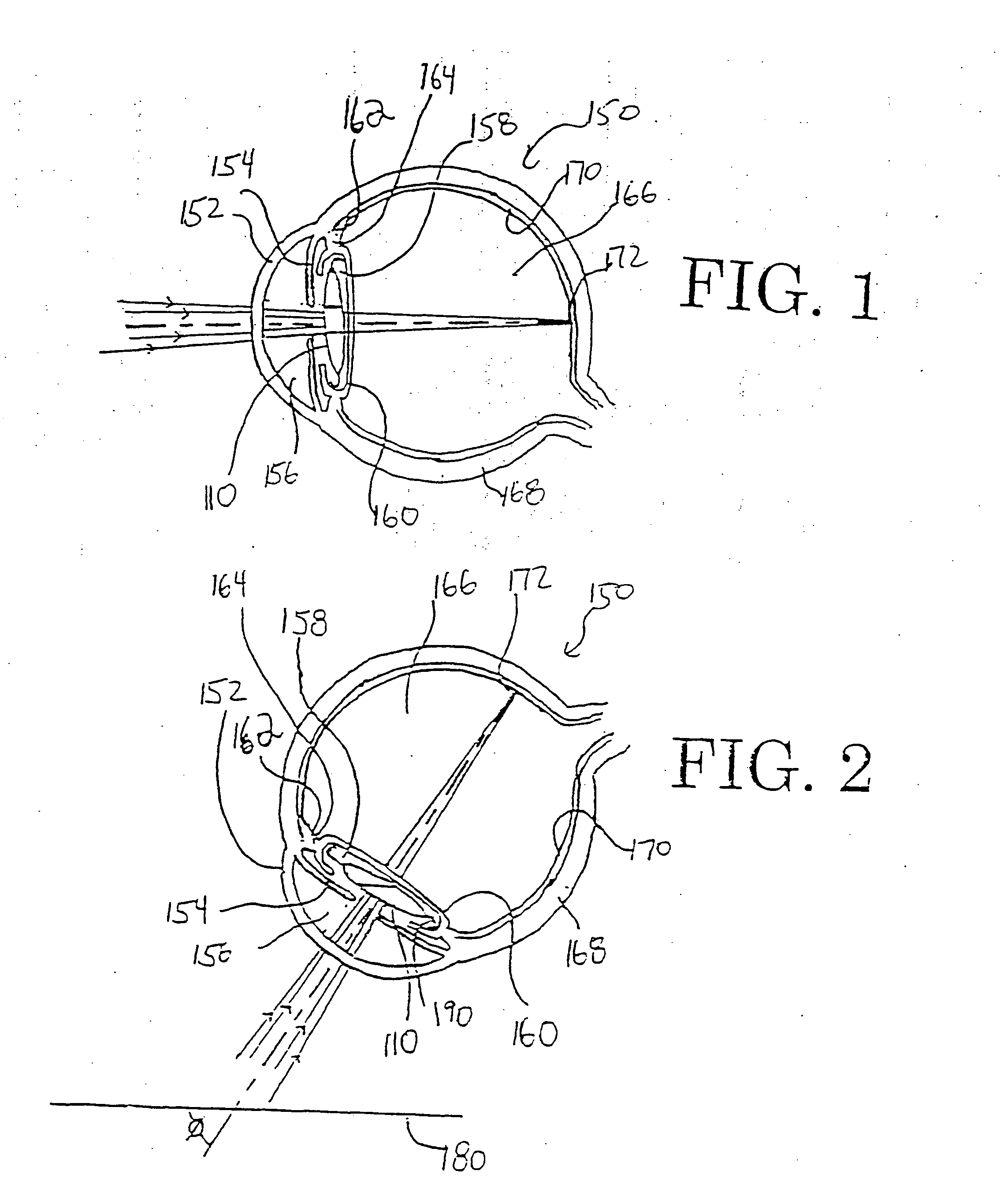 Multi-focal intraocular lens, and methods for making and using same