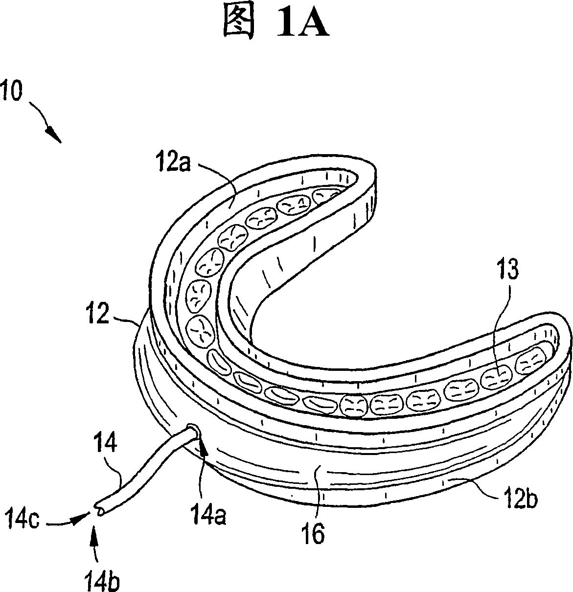 Methods and devices for maintaining an open airway