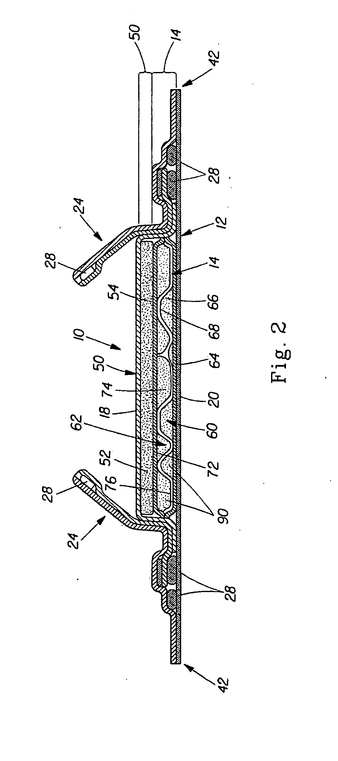 Disposable Absorbent Article With Sealed Absorbent Core With Substantially Continuously Distributed Absorbent Particulate Polymer Material