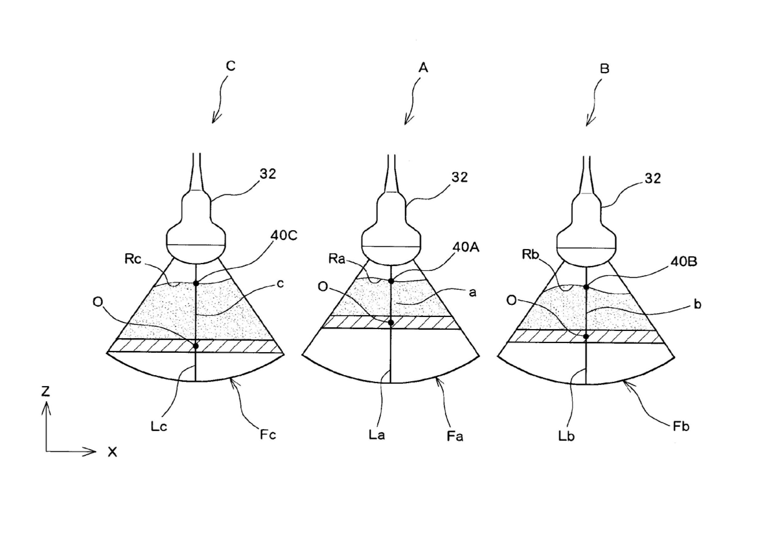 Ultrasonic diagnostic system