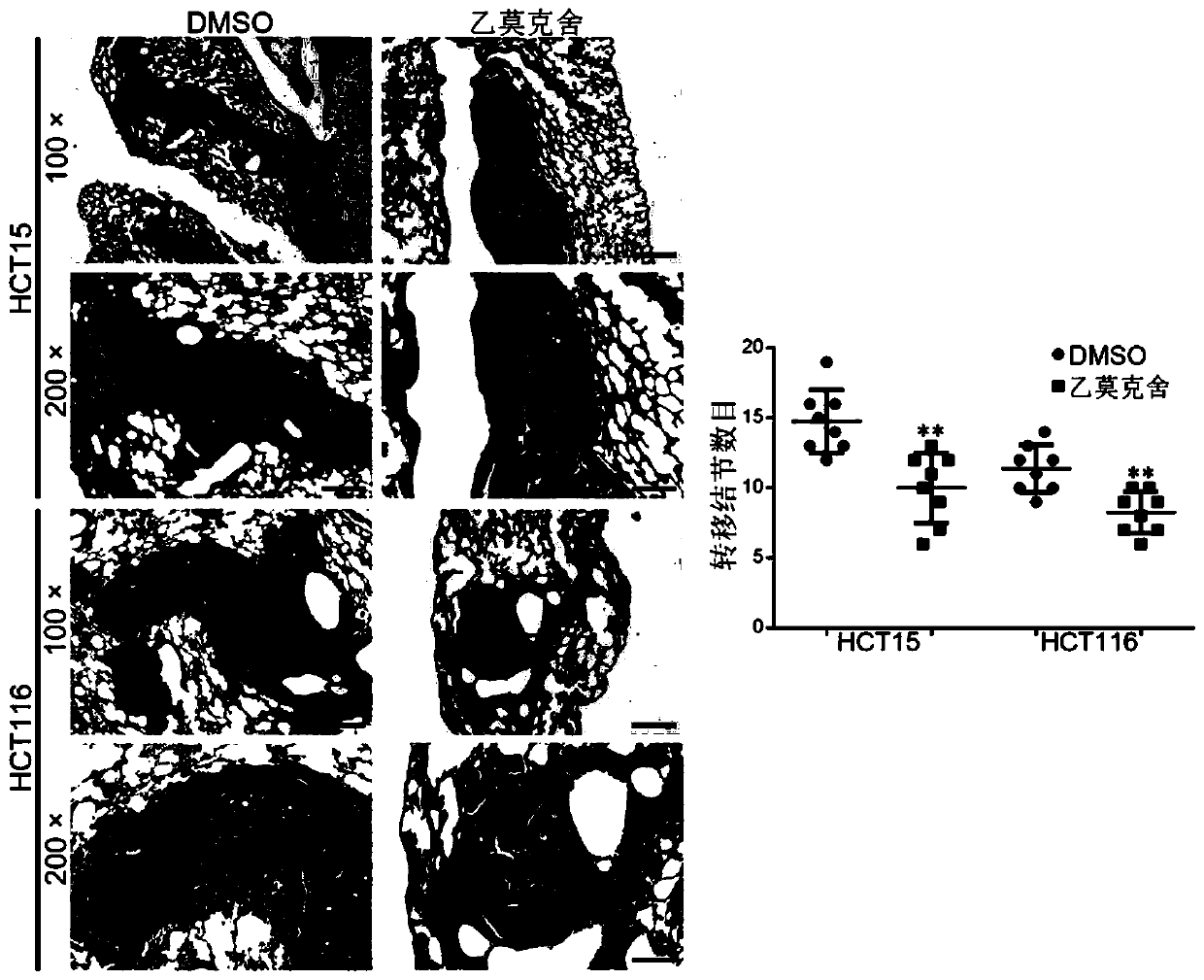 The application of ethyl moxel in the treatment of colorectal cancer