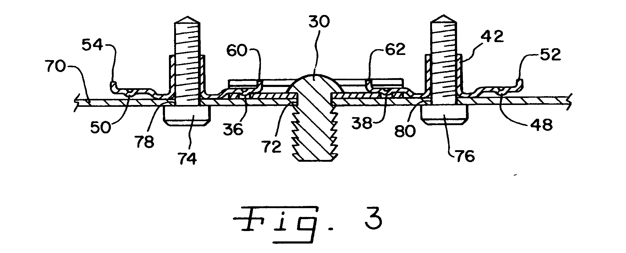 Modular nut plate