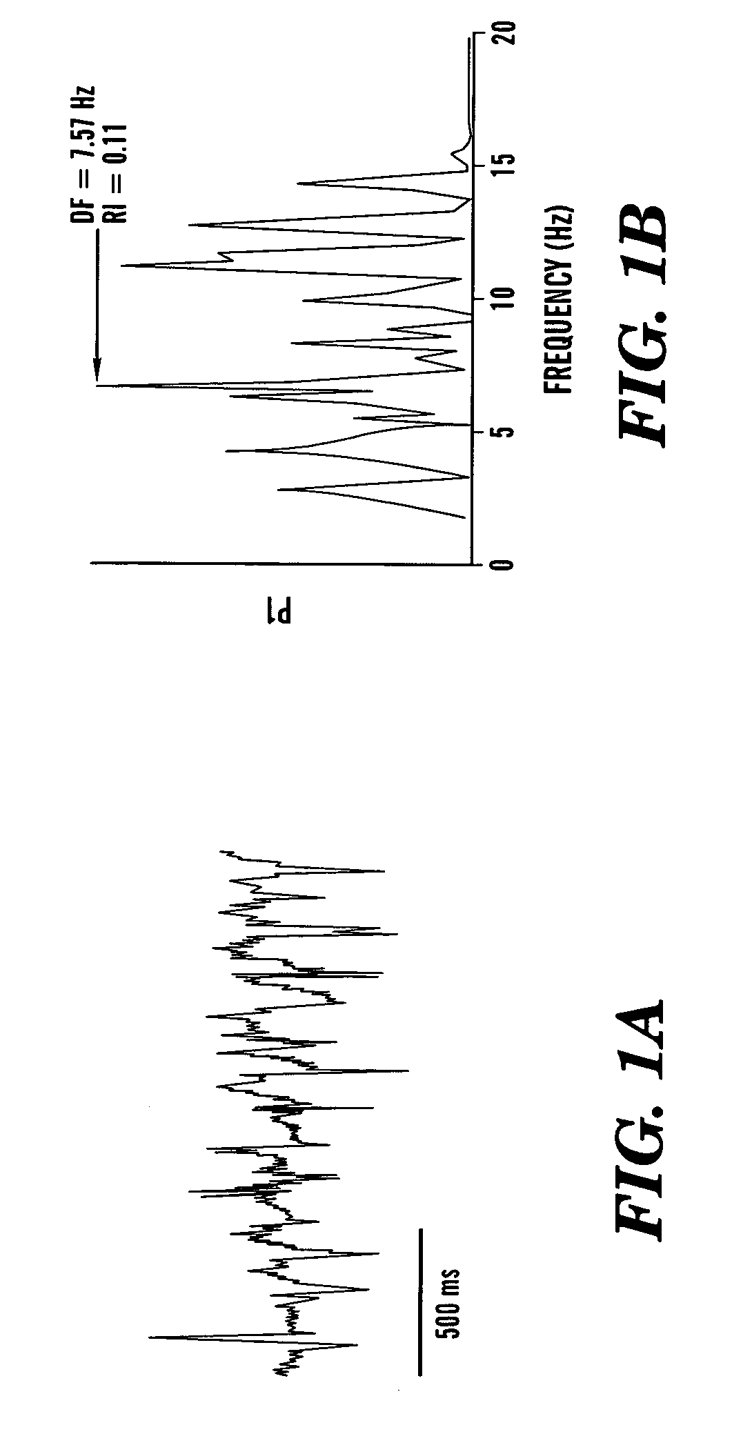 Method and algorithm for spatially identifying sources of cardiac fibrillation