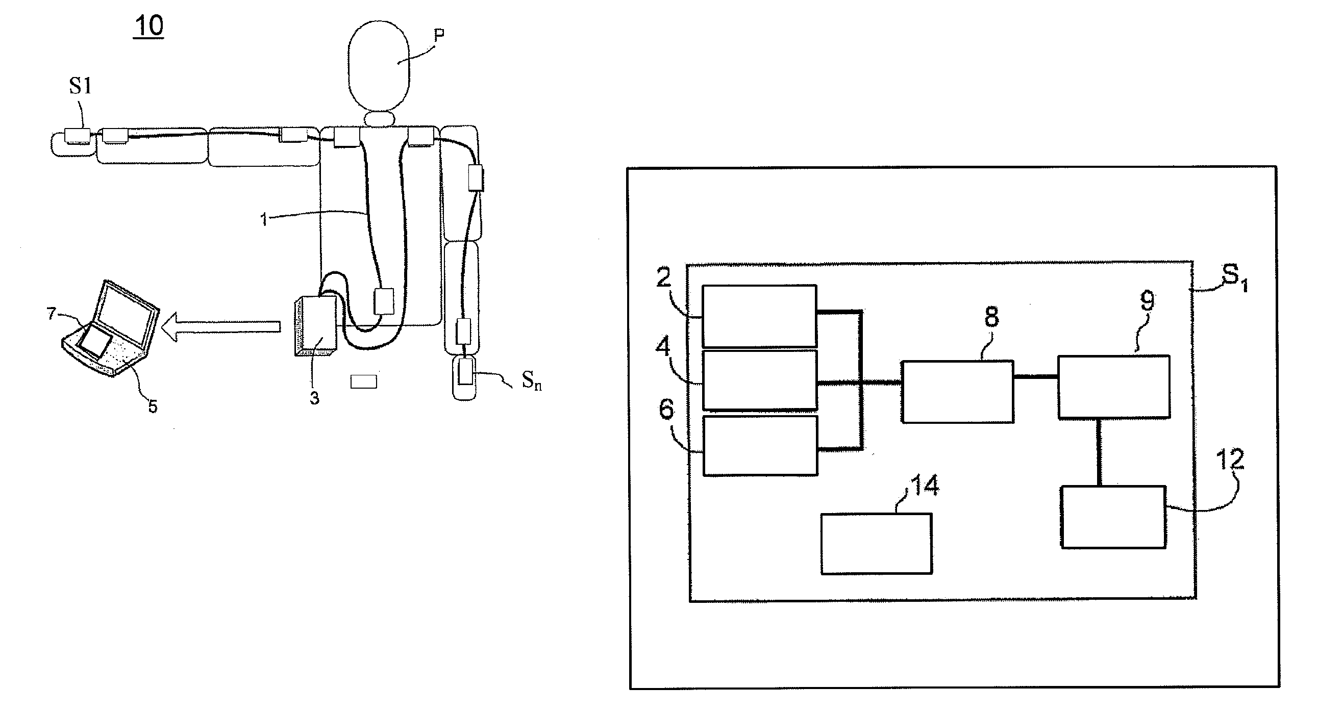 Sytem and a Method for Motion Tracking Using a Calibration Unit
