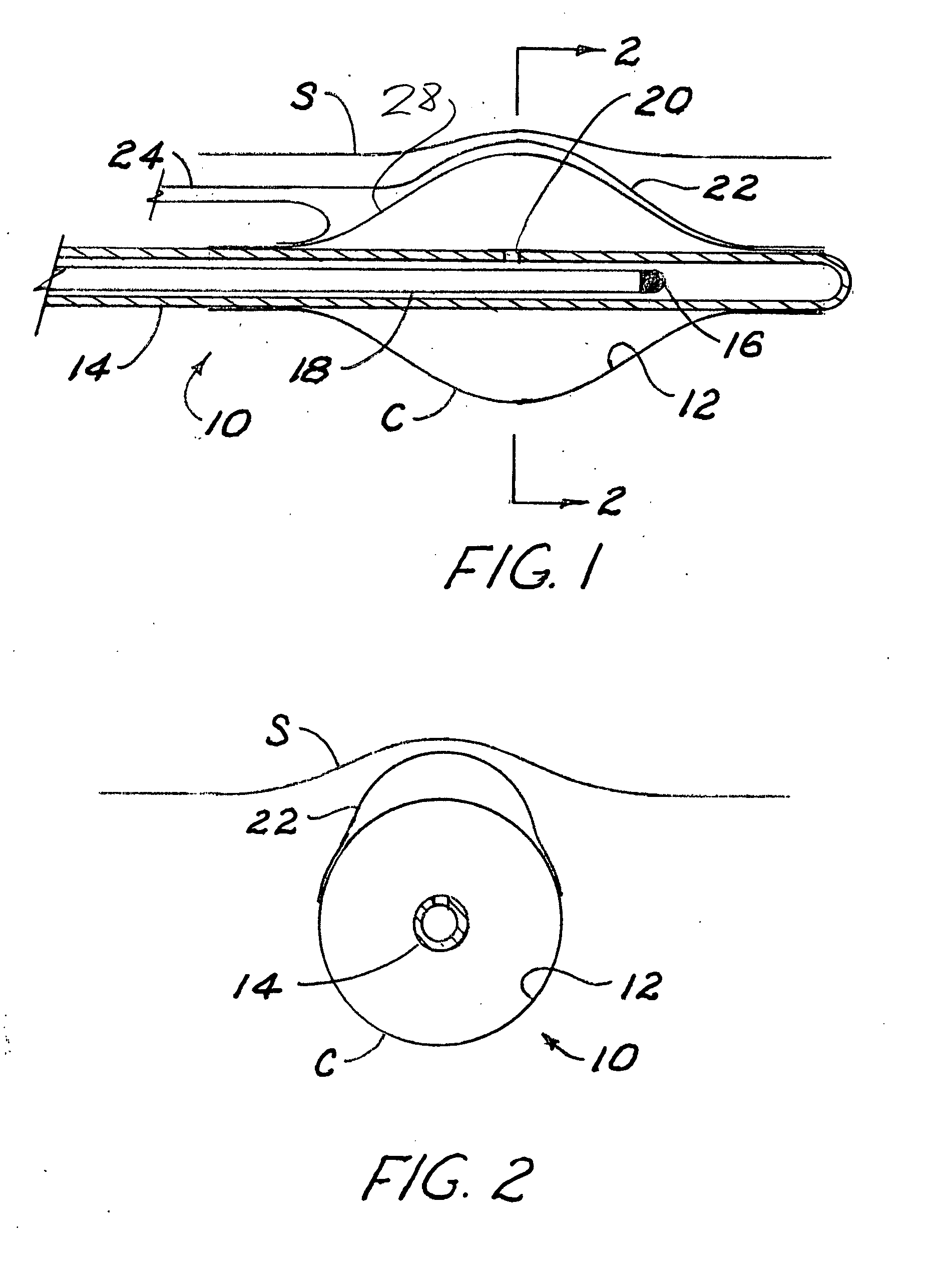 Method and apparatus for modifying distance from a brachytherapy radiation source to sensitive anatomical structures