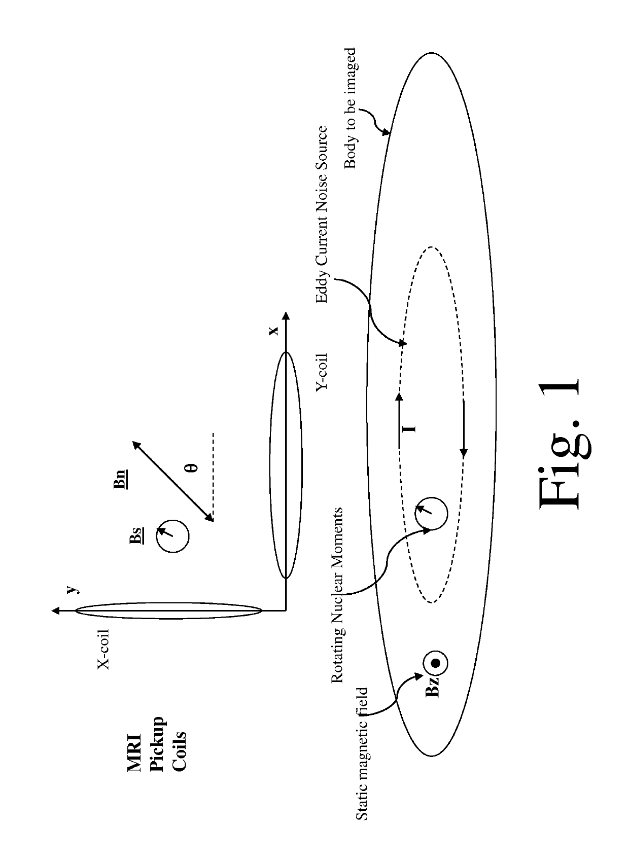 System and method for noise reduction in magnetic resonance imaging