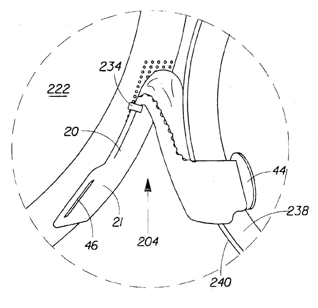 Method of dynamically pre-fastening a disposable absorbent article having a slot-and-tab fastening system
