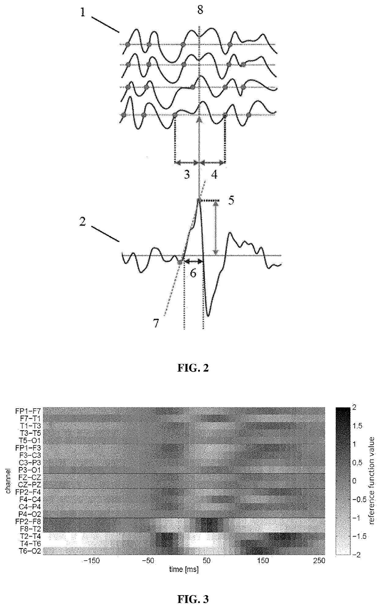 Method for identification of pathological brain activity from scalp electroencephalogram