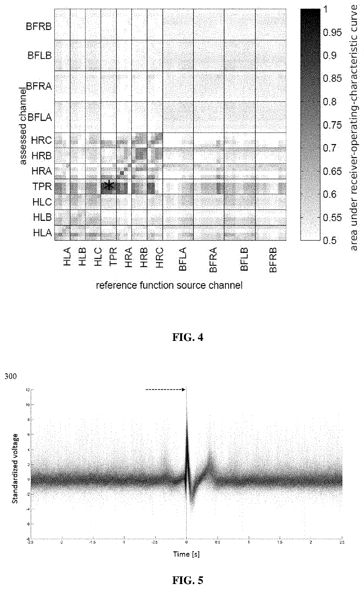 Method for identification of pathological brain activity from scalp electroencephalogram