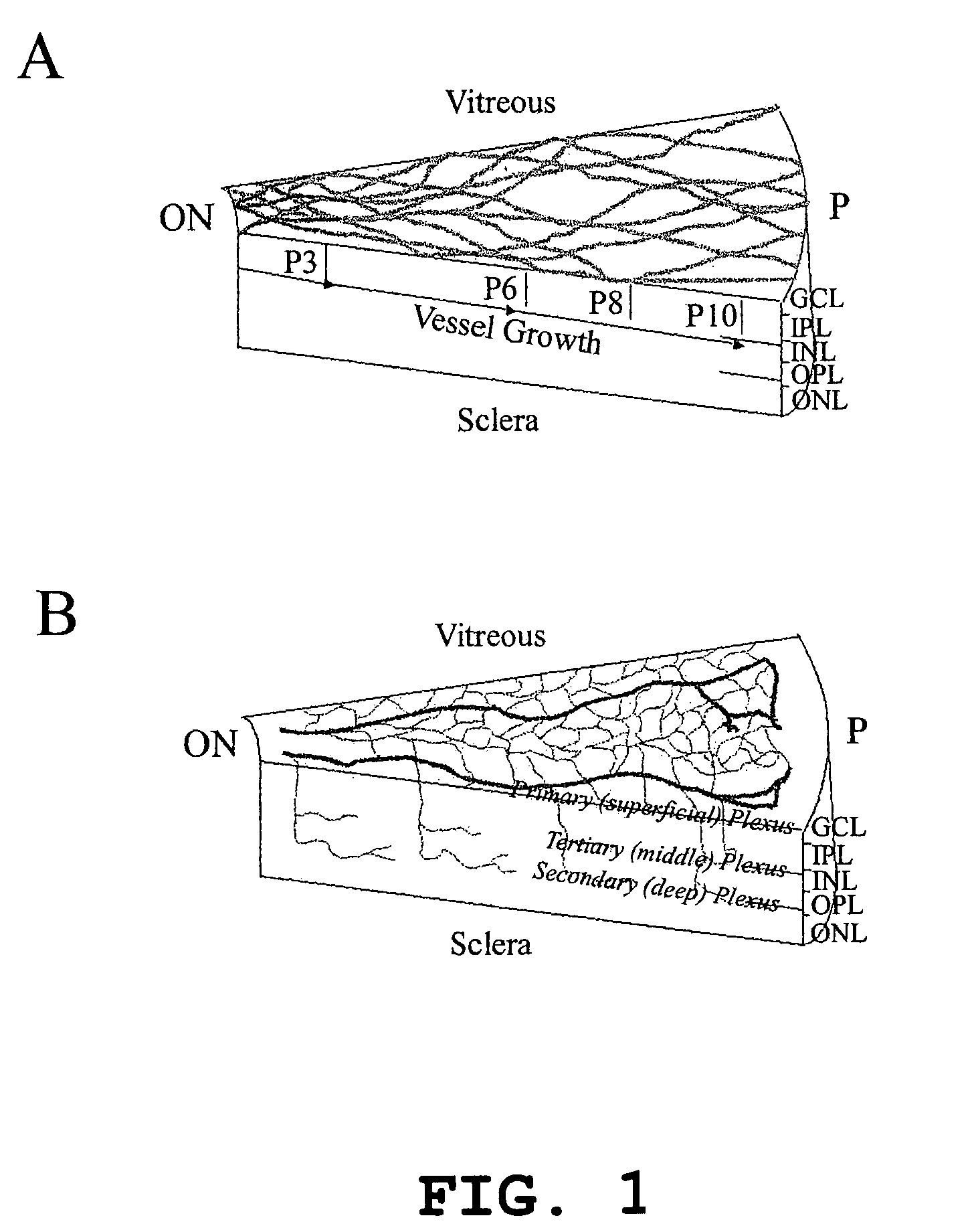 Hematopoietic stem cells and methods of treatment of neovascular eye diseases therewith