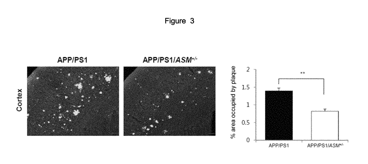 Composition comprising ASM inhibitor as active ingredient for preventing or treating degenerative neurological disorders