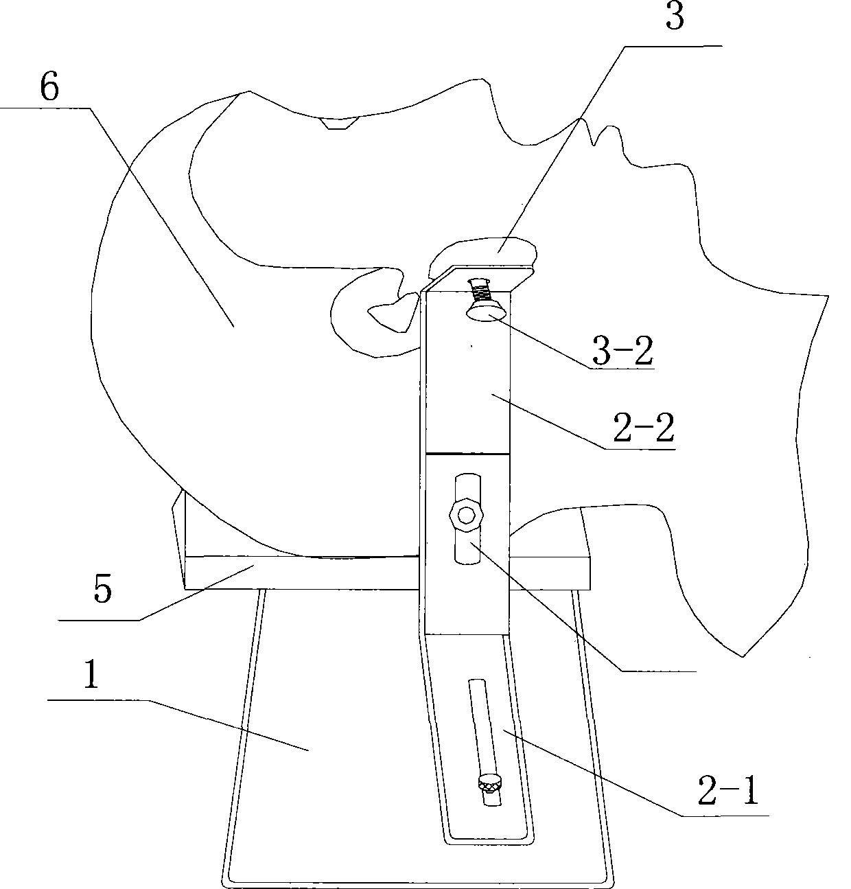 Lower jaw supporting device