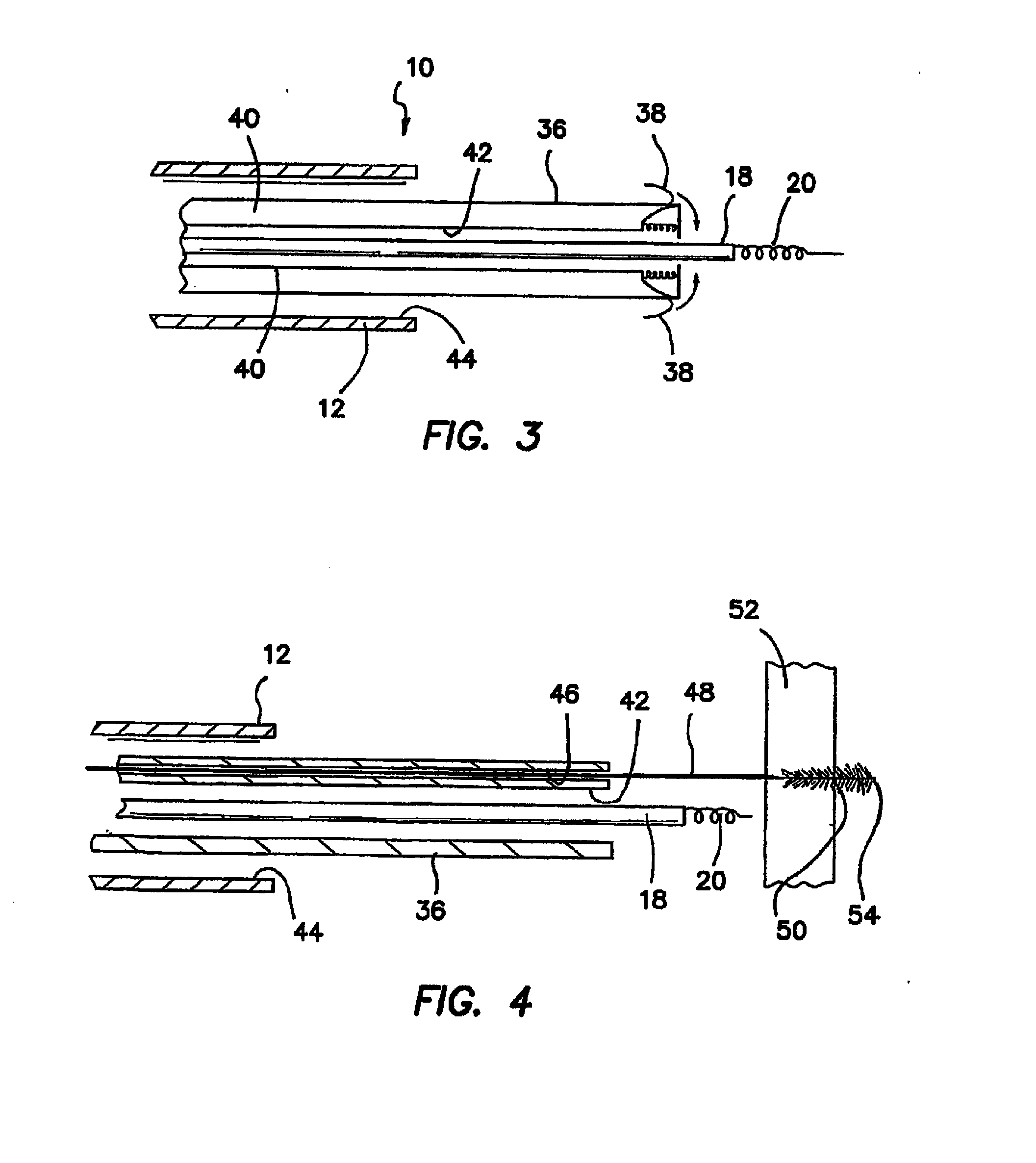 Method for accessing the coronary microcirculation and pericardial space