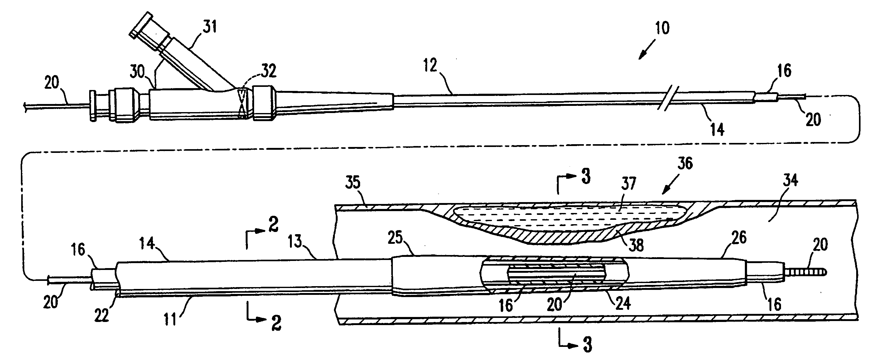 Device for treating vulnerable plaque