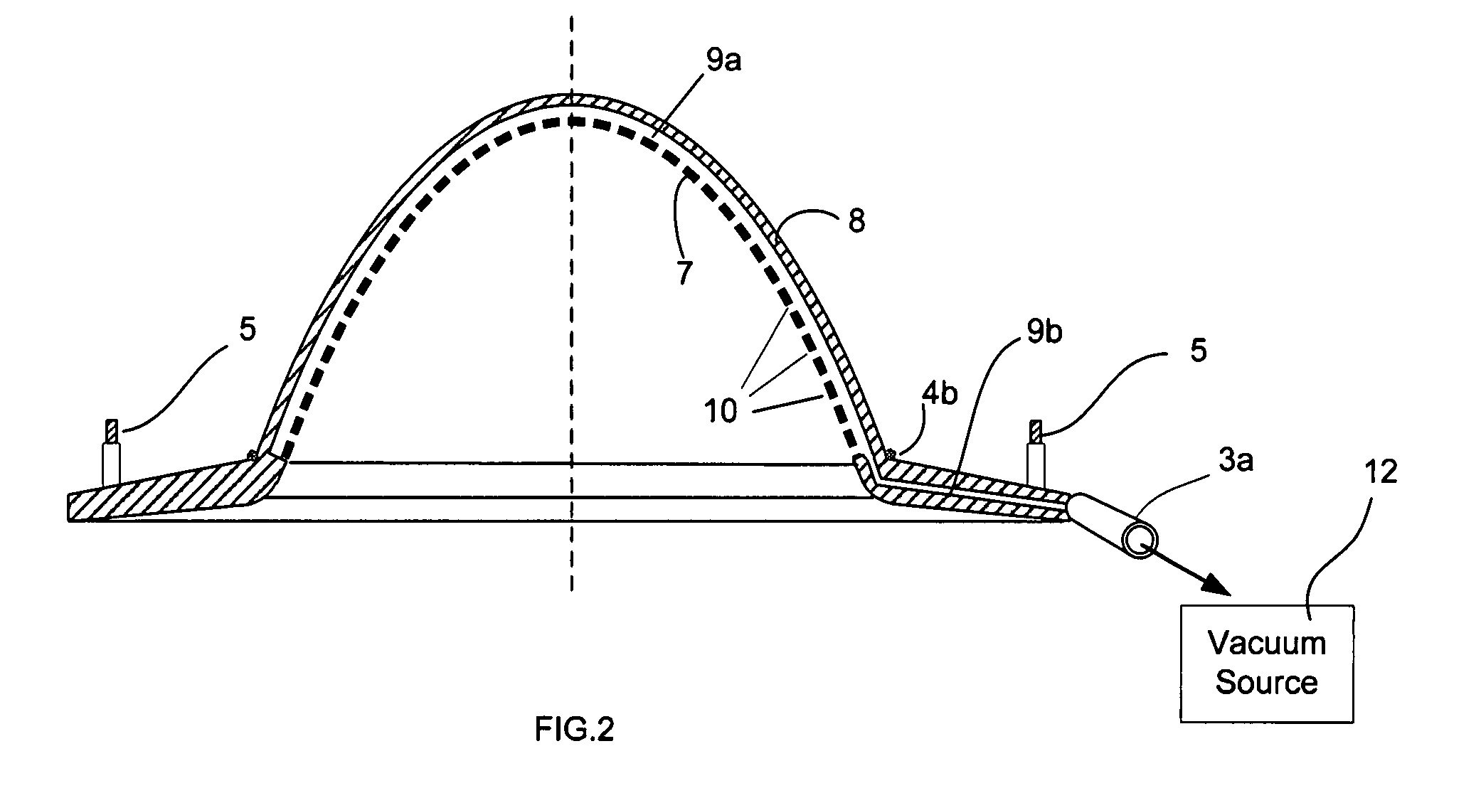 Method and device for immobilization of the human breast in a prone position for radiotherapy