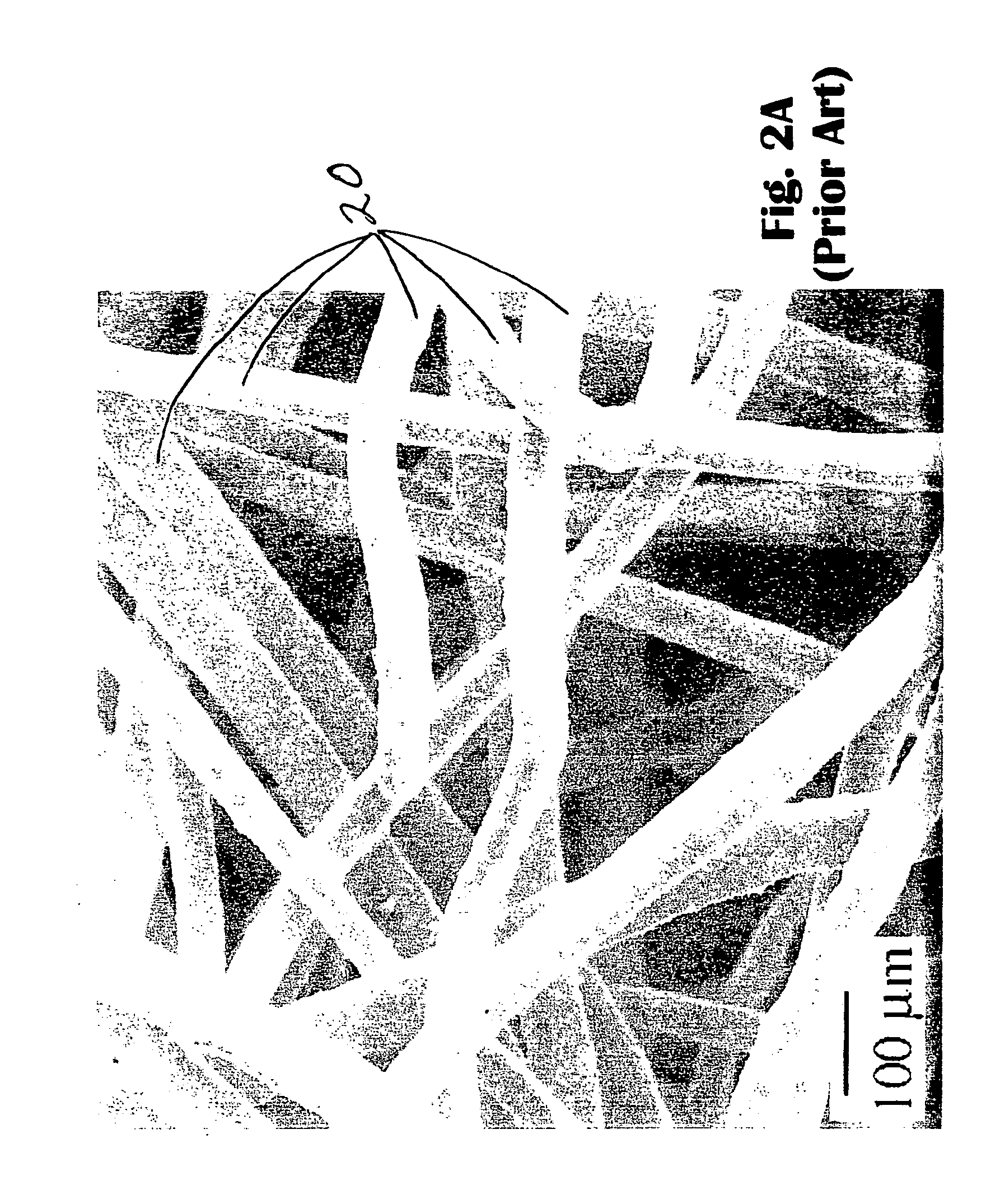 Advanced catalyst system prepared from a whiskered aluminum-containing metallic alloy substrate