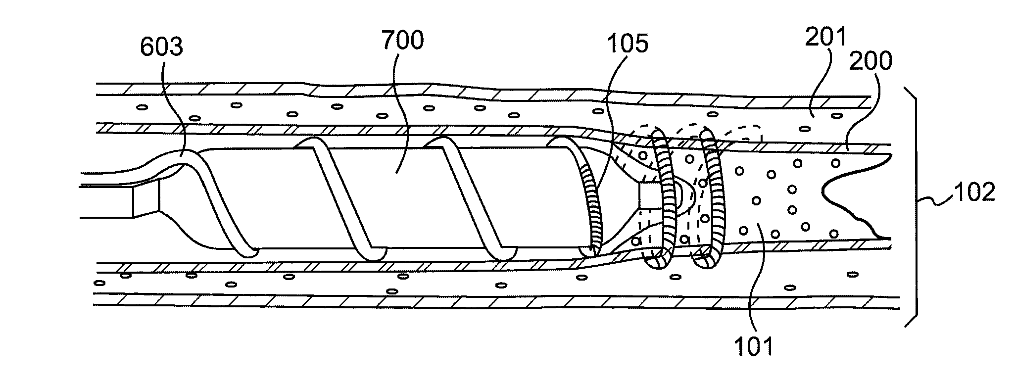 Endovascular devices and methods