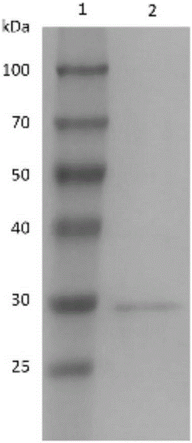Scylla serrata reovirus colloidal gold immunochromatographic assay reagent strip and preparing method and using method thereof