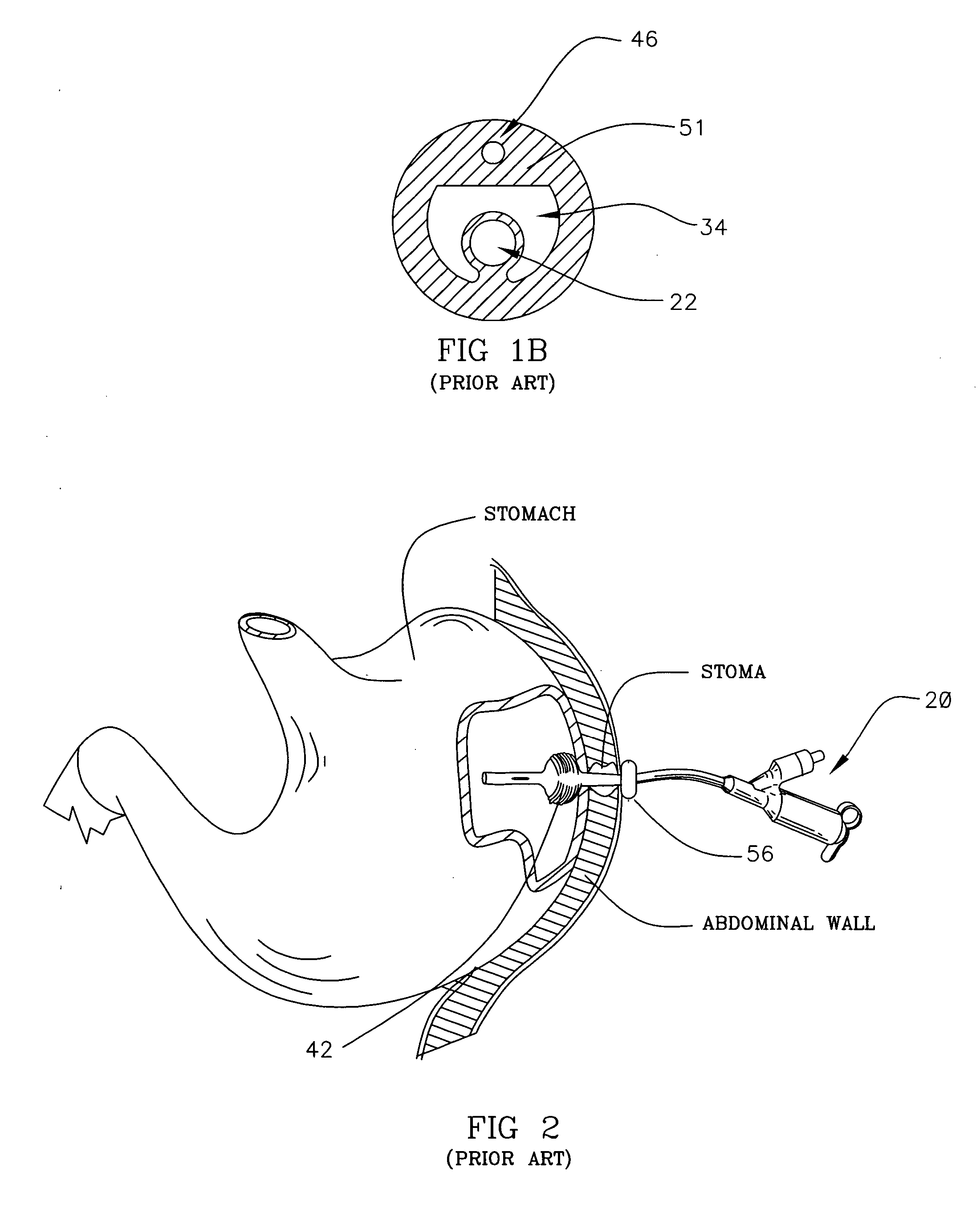 Connector with connection mechanism adapted for releasable interconnection with tube