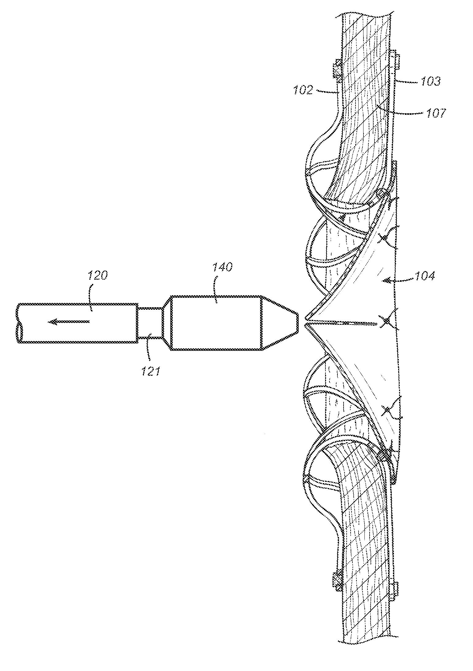 Mounting tool for loading a prosthesis