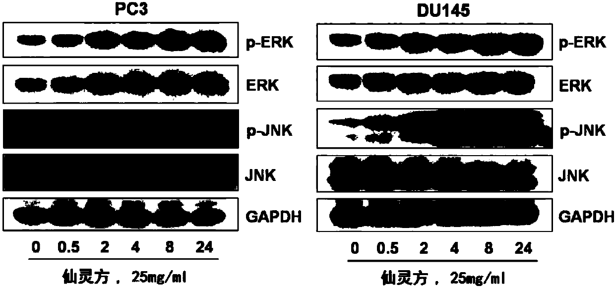 A traditional Chinese medicine composition for treating prostate cancer and its preparation method