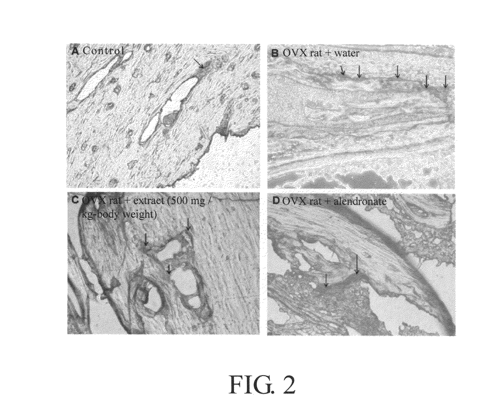 Method for inhibiting formation and/or activation of osteoclasts using flemingia macrophylla extract or lespedeza flavanone A