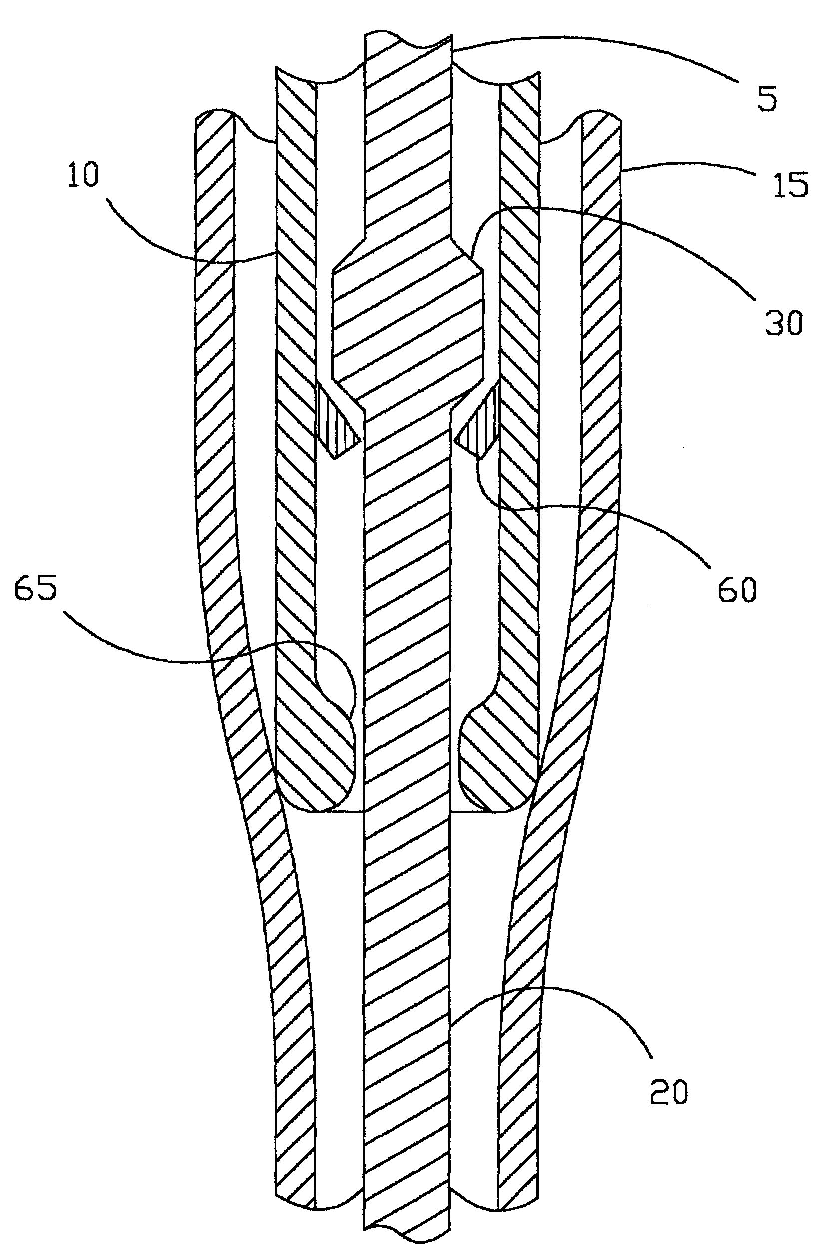 Distal protection and delivery system and method