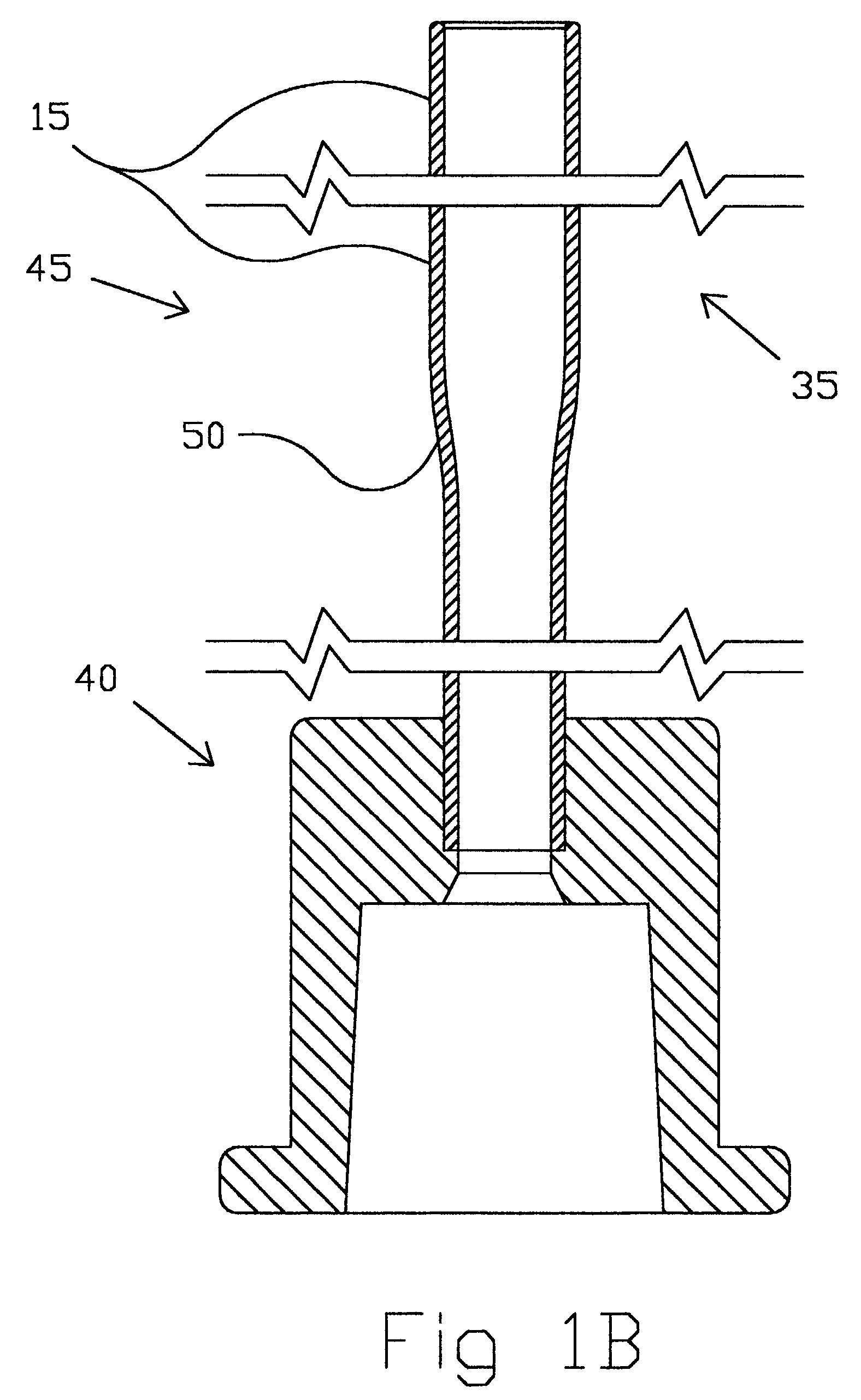 Distal protection and delivery system and method