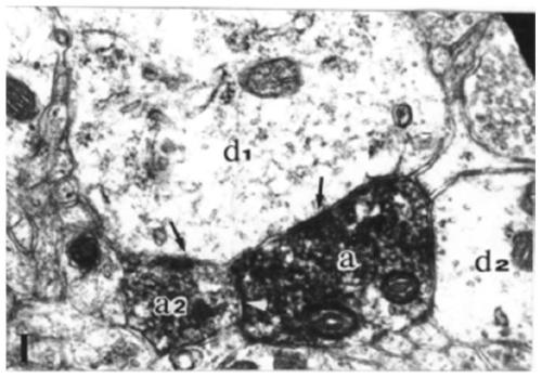 HDN staining solution and kit for specific color development of horseradish peroxidase by using HDN staining solution