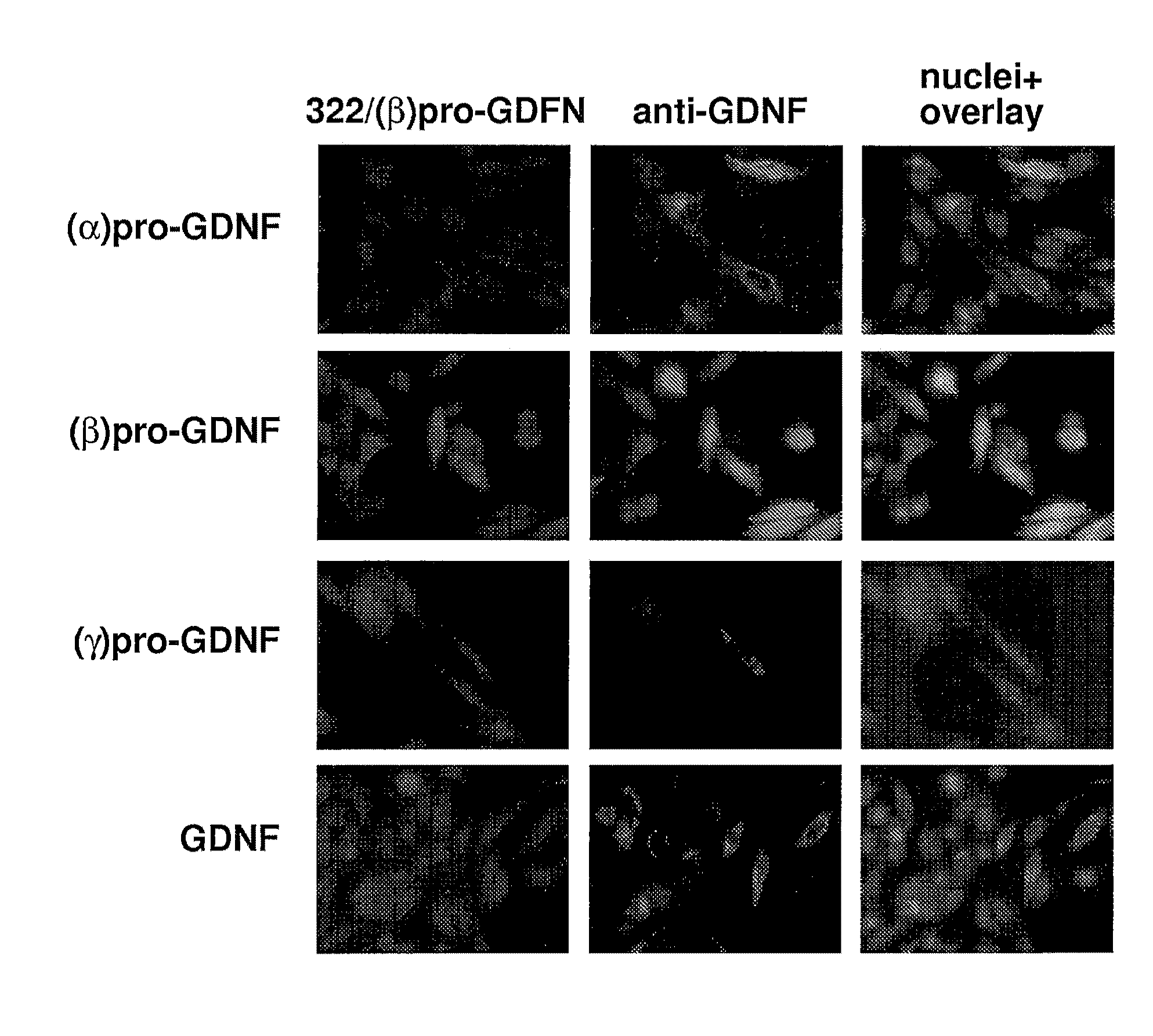 Splice variants of gdnf and uses thereof