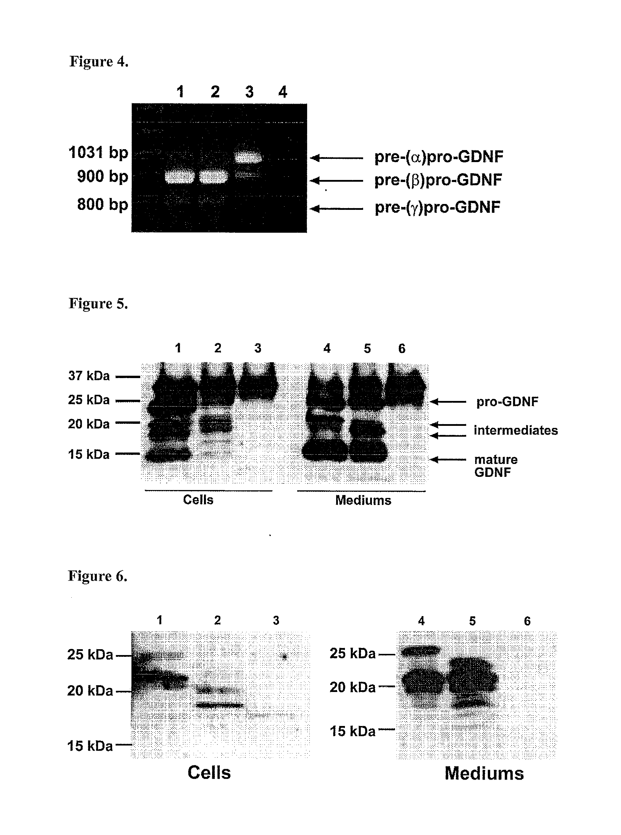 Splice variants of gdnf and uses thereof