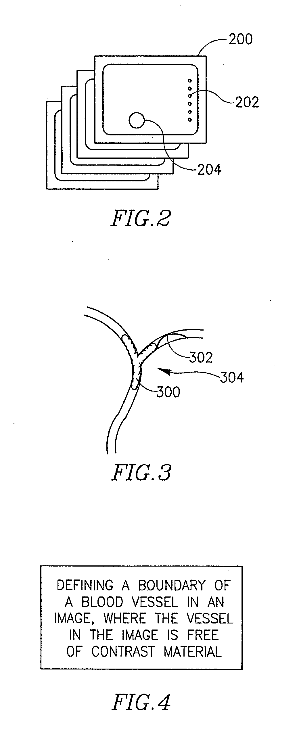 System and method for segmenting structures in a series of images using non-iodine based contrast material