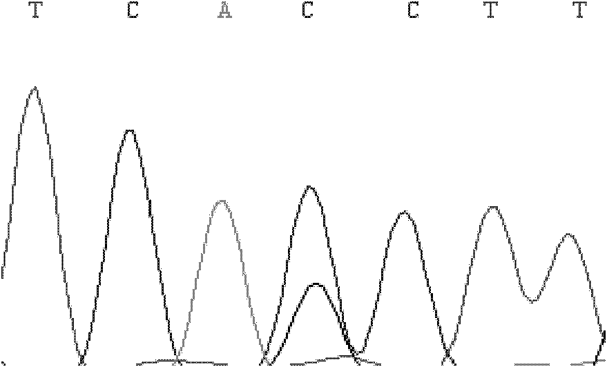 Method for detecting ox FTO (Fat Mass and Obesity-associated) gene single nucleotide polymorphism (SNP)