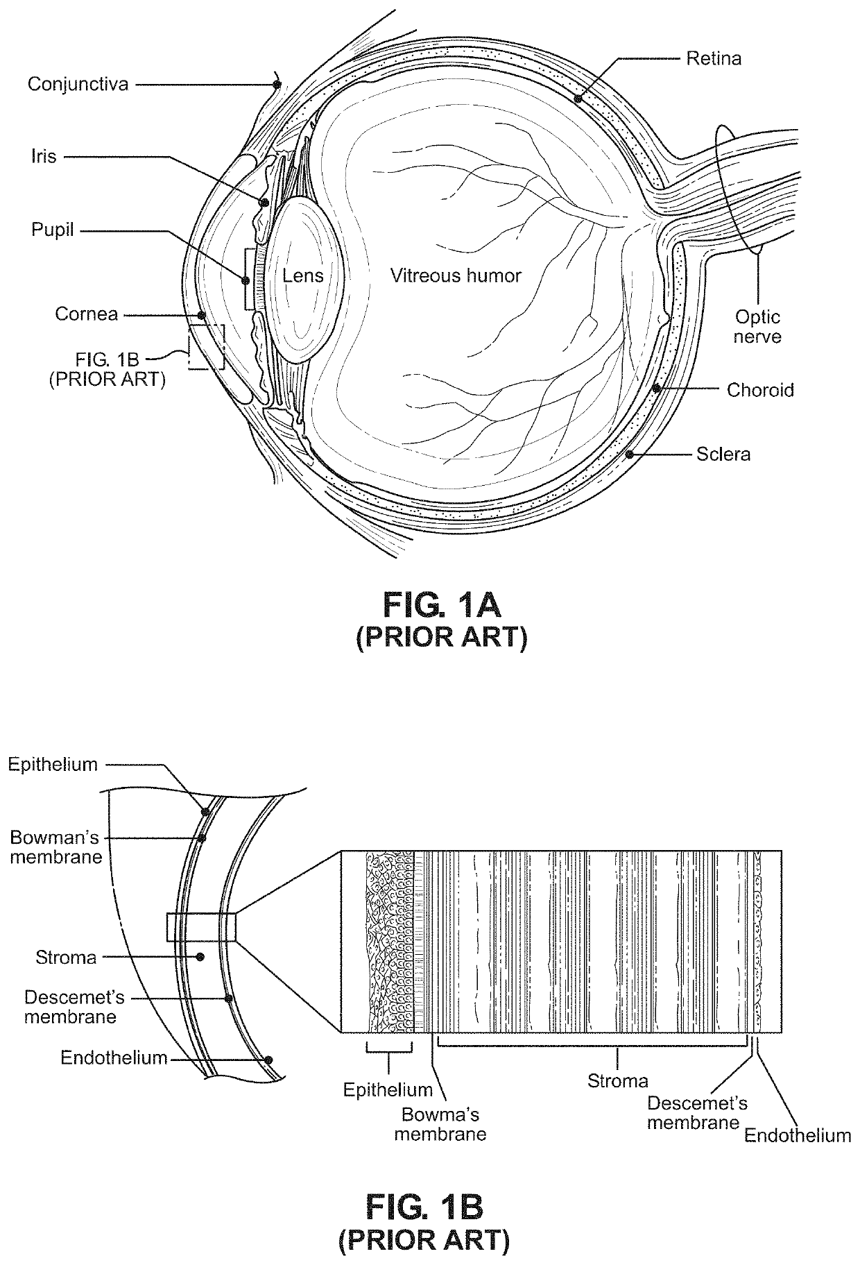 Method of and system for automated machine-assisted detection of ocular disease conditions in human eyes captured using visible illumination light sources and digital camera systems