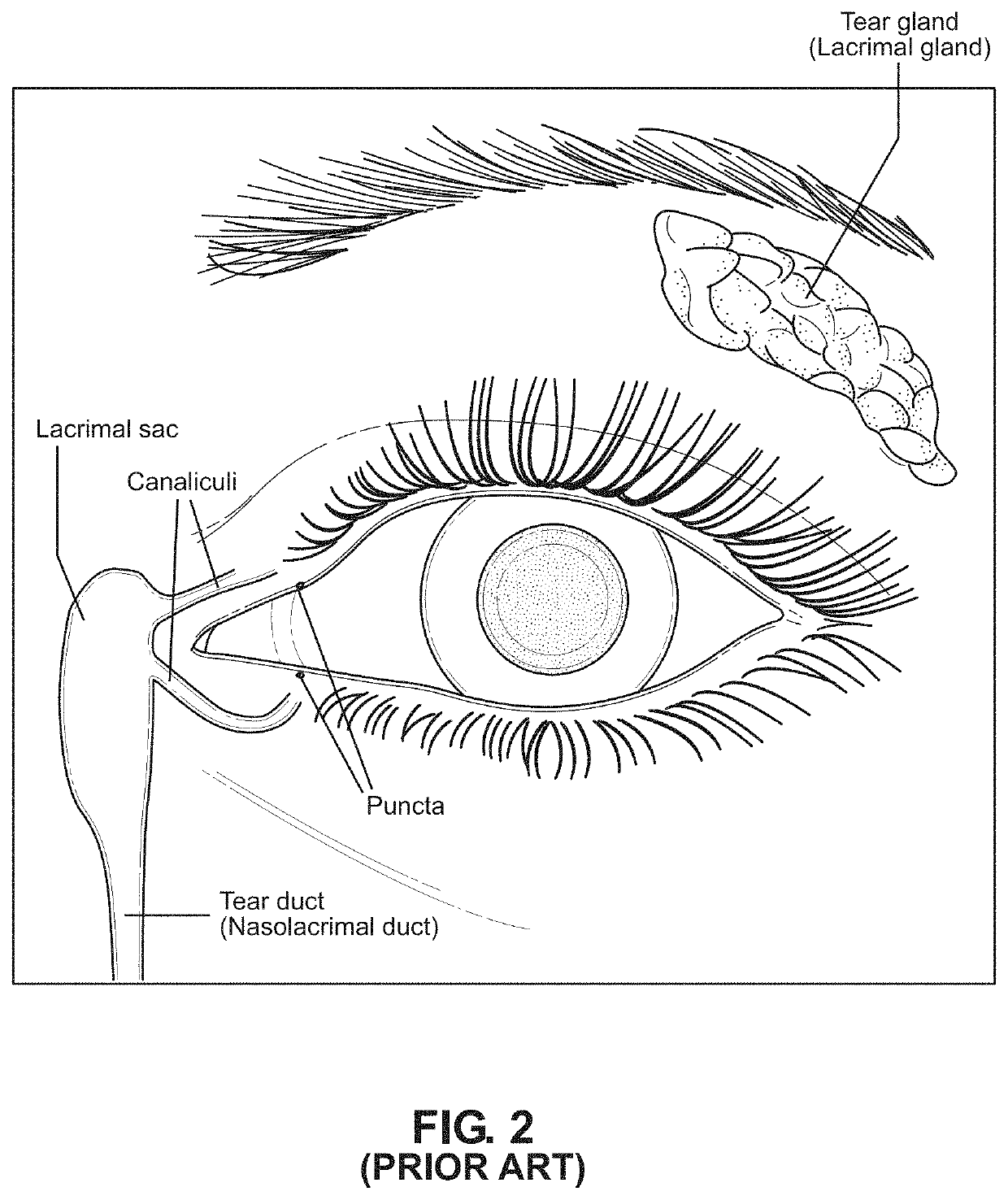 Method of and system for automated machine-assisted detection of ocular disease conditions in human eyes captured using visible illumination light sources and digital camera systems