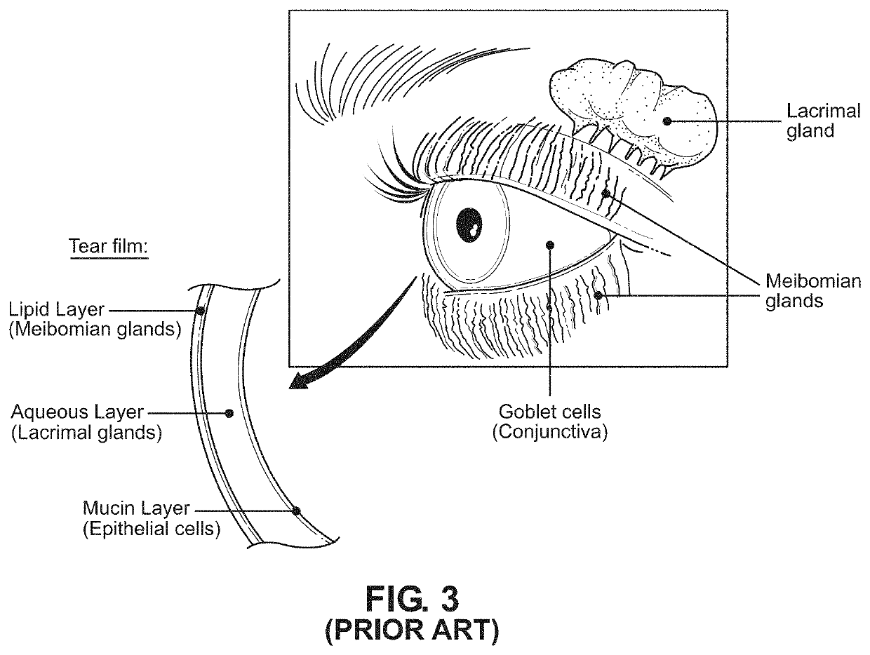 Method of and system for automated machine-assisted detection of ocular disease conditions in human eyes captured using visible illumination light sources and digital camera systems