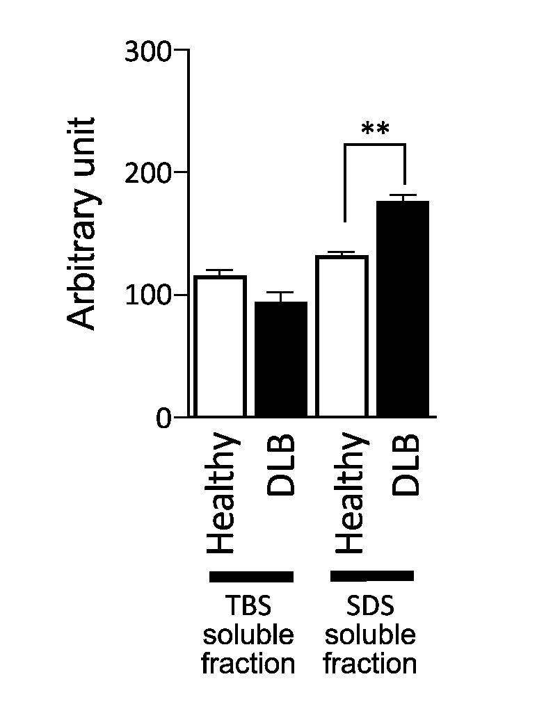 Method for treating and/or preventing neurodegenerative disease by adiponectin receptor agonist