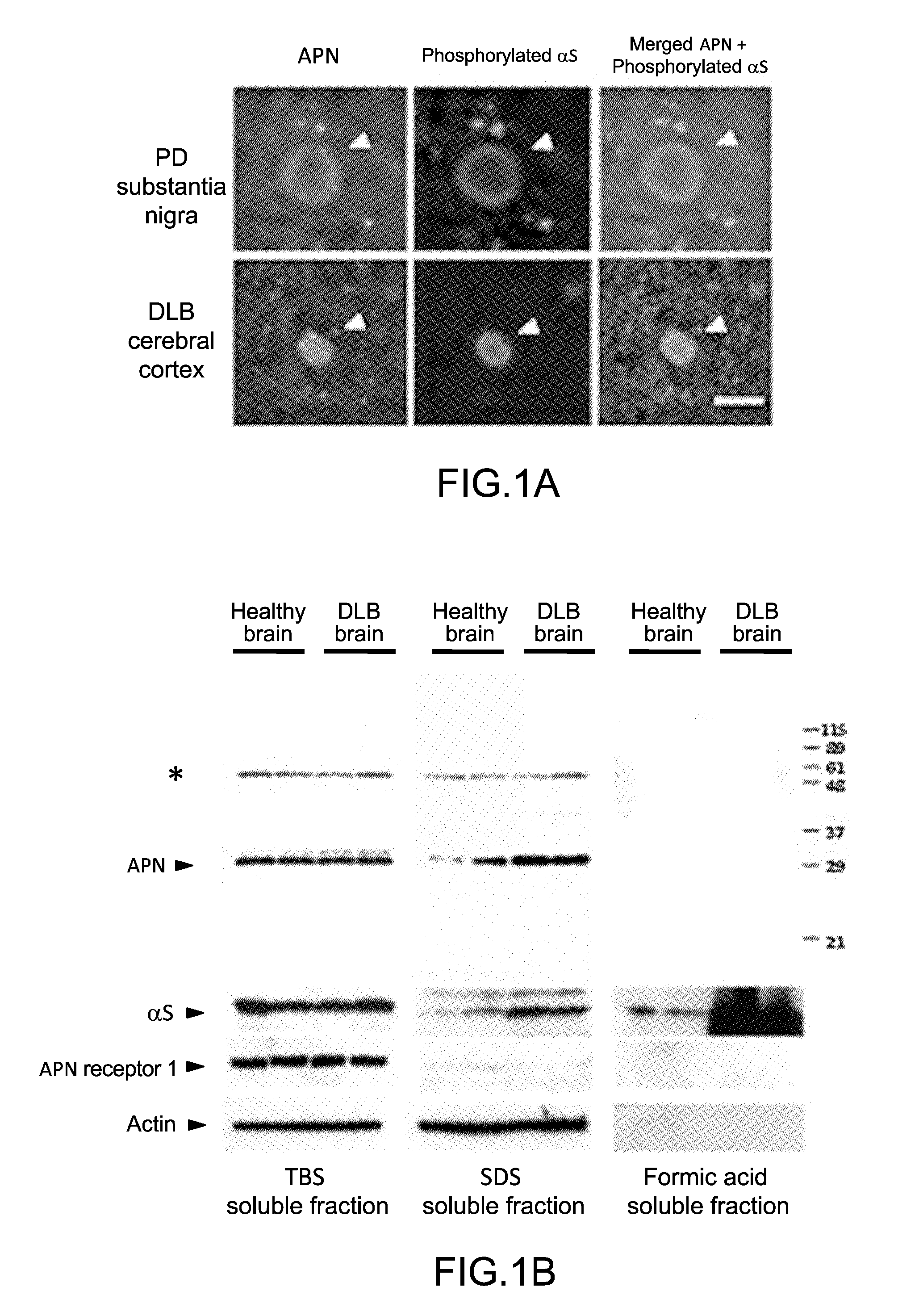 Method for treating and/or preventing neurodegenerative disease by adiponectin receptor agonist