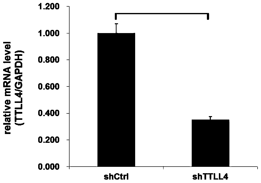 Application of human TTLL4 gene and related products