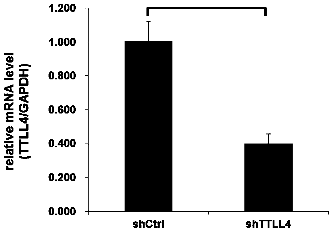 Application of human TTLL4 gene and related products