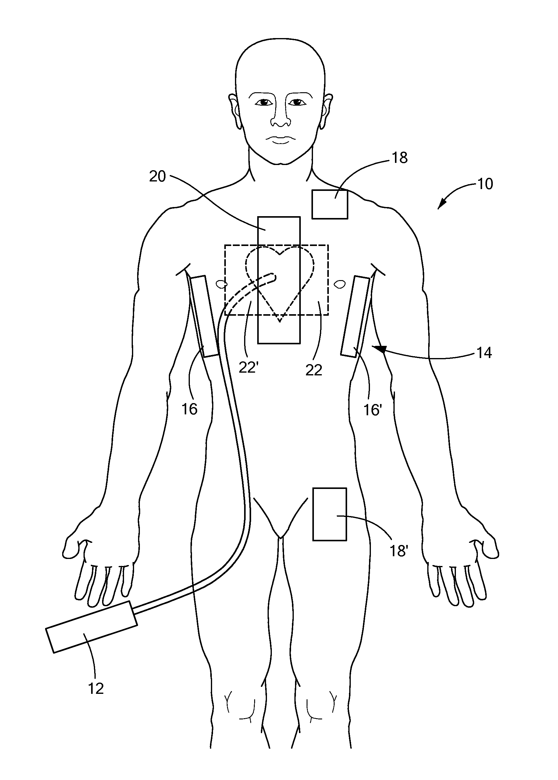 Systems and methods of performing medical procedures