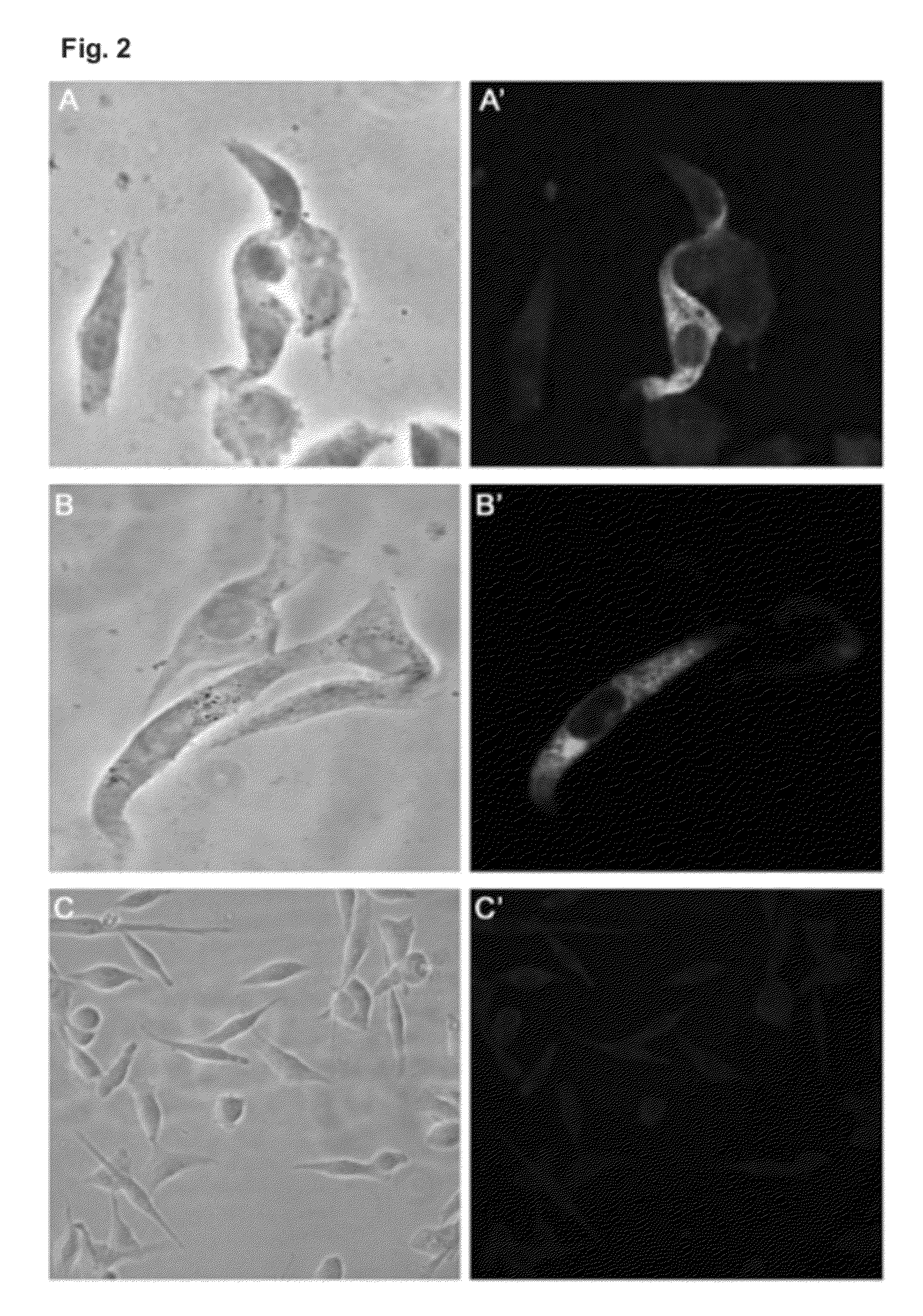 Method, kit, plasmid and composition for inducing an immune response to dengue virus, on the basis of DNA and chimeric virus vaccines