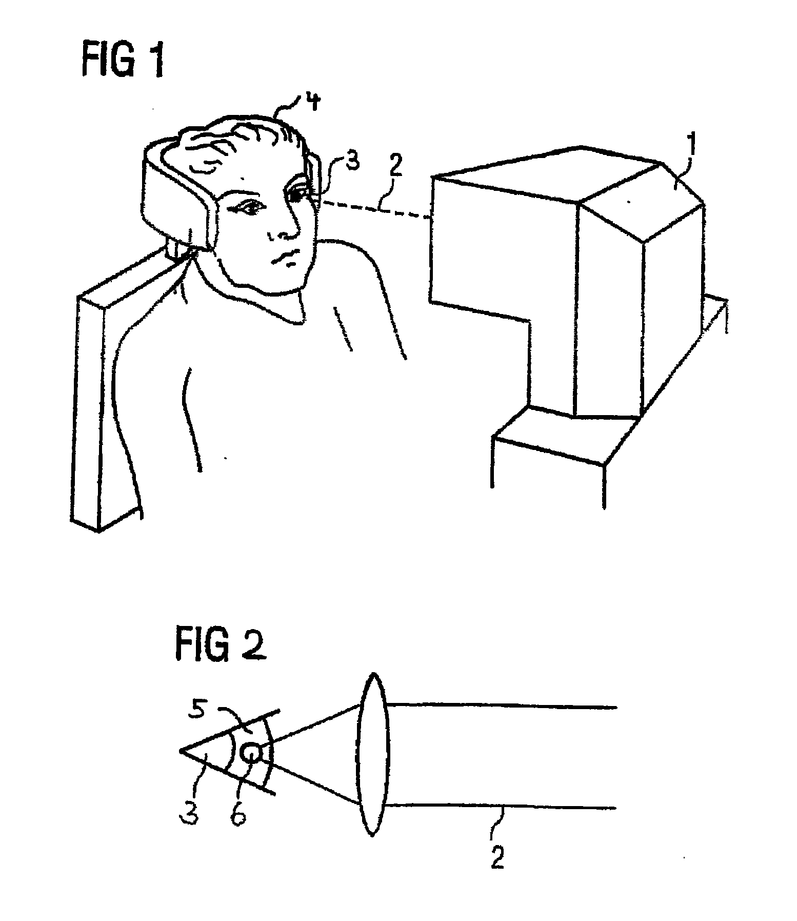Method for generating control data for eye surgery, and eye-surgical treatment device and method