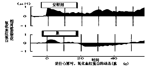 Method for preparing solid digestion-free protein from instant active pair protein