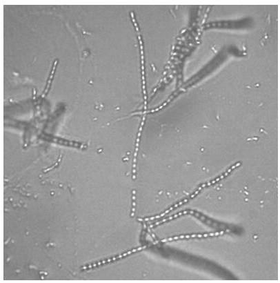 A Strain of Marine Streptomyces with Bacteriostatic Activity