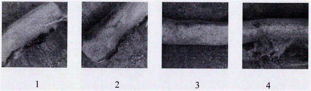 Pharmaceutical composition for treating atherosclerosis and application