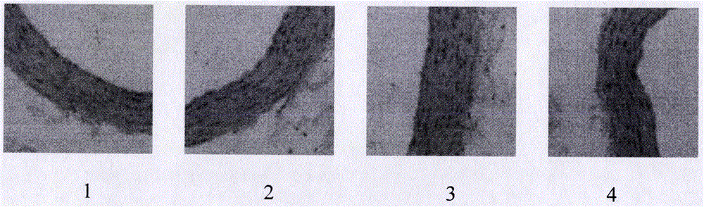 Pharmaceutical composition for treating atherosclerosis and application