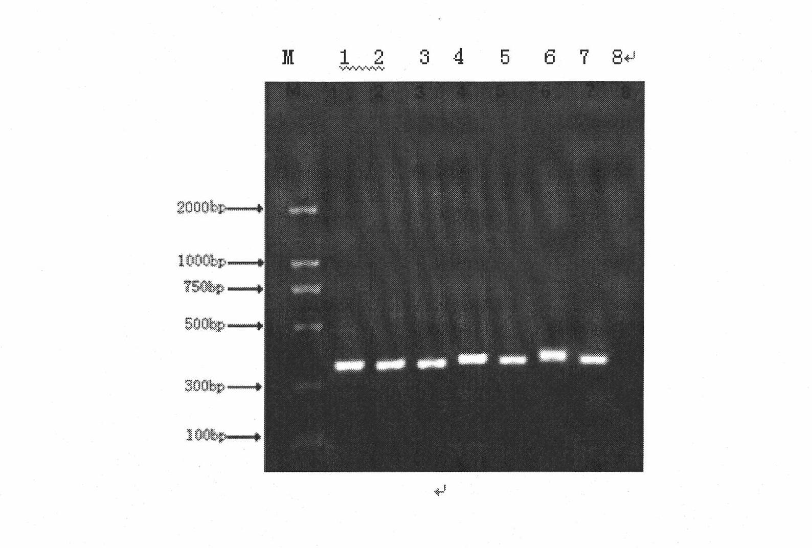 Rapid detection method of blood pathogenic bacteria based on CE-SSCP (Capillary Electrophoresis-Single Strand Conformation Polymorphism)